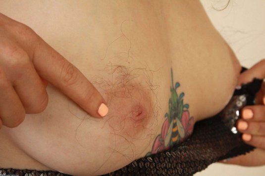 Сосок в подмышке