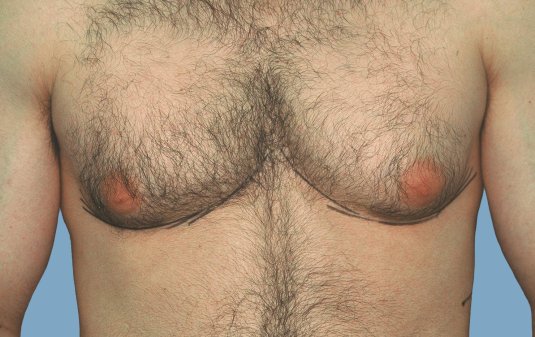 Мужская грудь