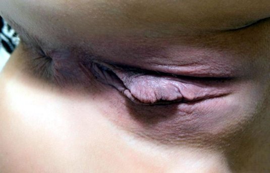 Фотографии