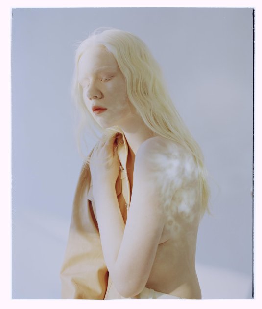 Девушка альбинос