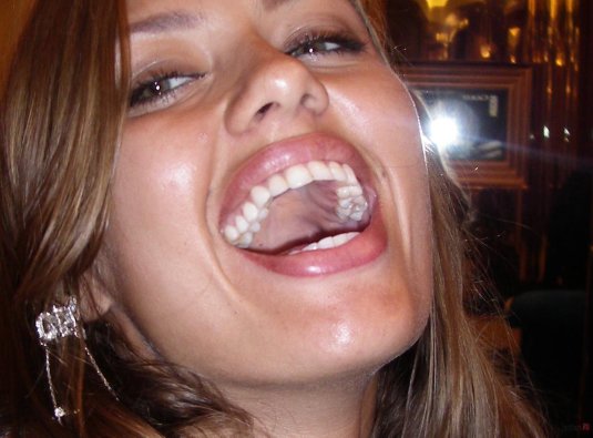 Боня виктория до пластики