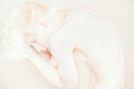 Игорь клепнев альбинос