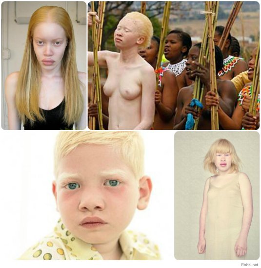 Дети альбиноса