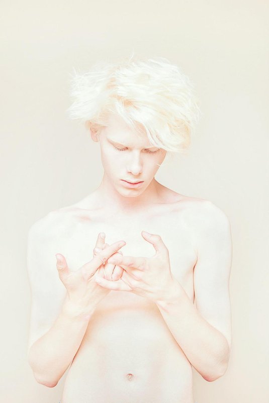 Саша смирнов альбинос