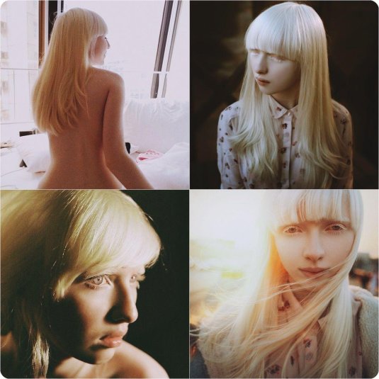 Настя жидкова альбинос