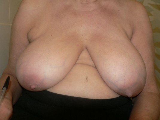 Огромные обвисшие сиськи