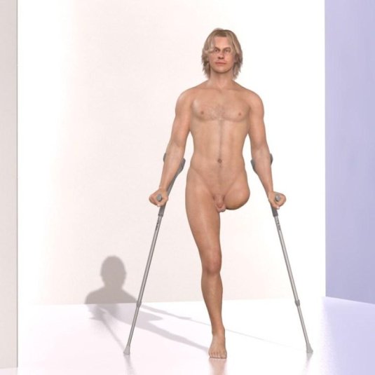 Человек на костылях