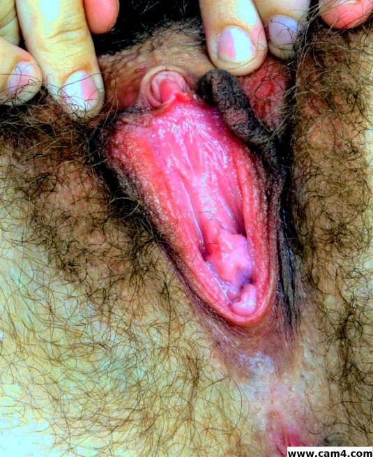 Гениталии у женщин