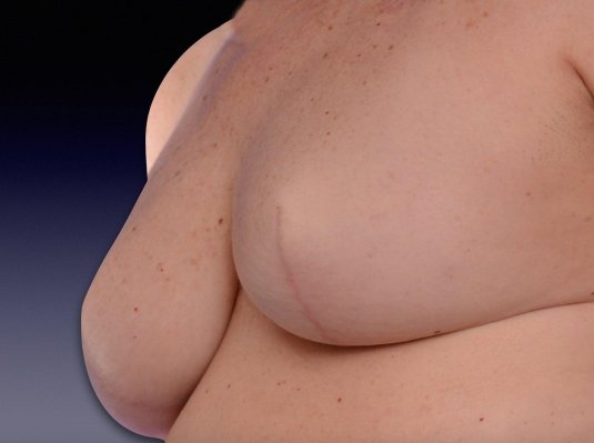 Женская груди