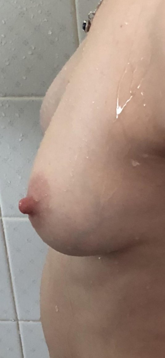 Молочная железа