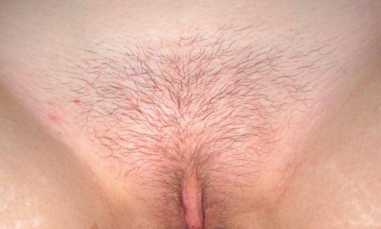 Бикини глубокое депиляция