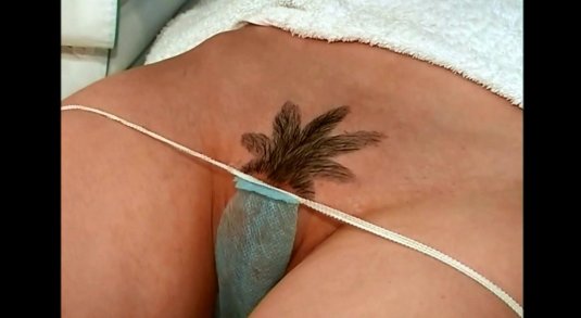 Интимная стрижка