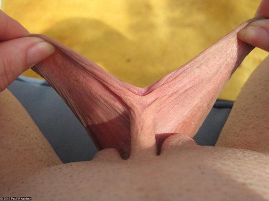 Лабиопластика половых губ