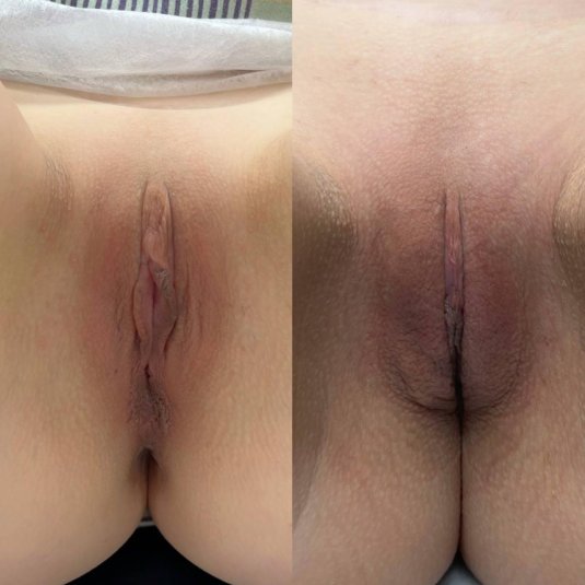 Секс девушек