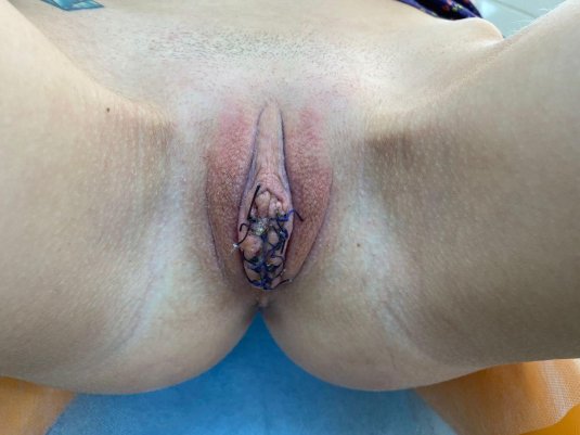 Клоп водомерка