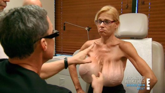 Старая силиконовая грудь