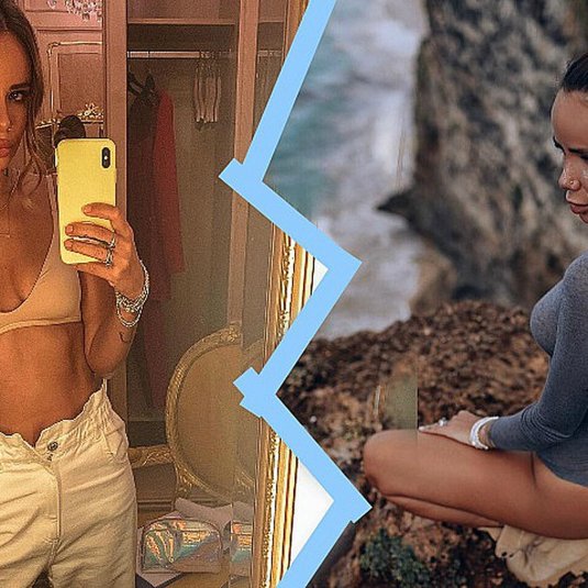 Айза анохина до пластики