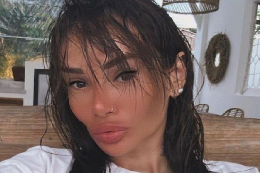 Айза анохина до пластики