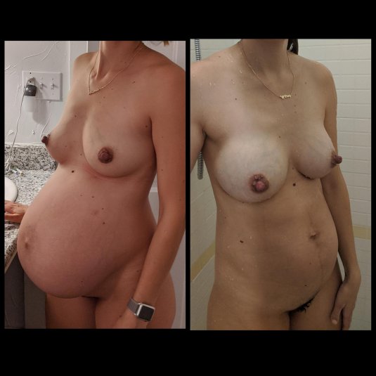 Грудь беременной девушки