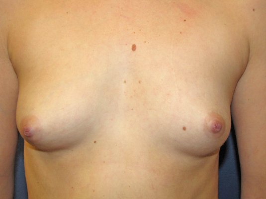 Маленькая сиська