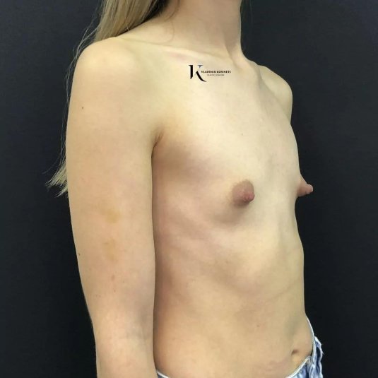 Грудь нулевка