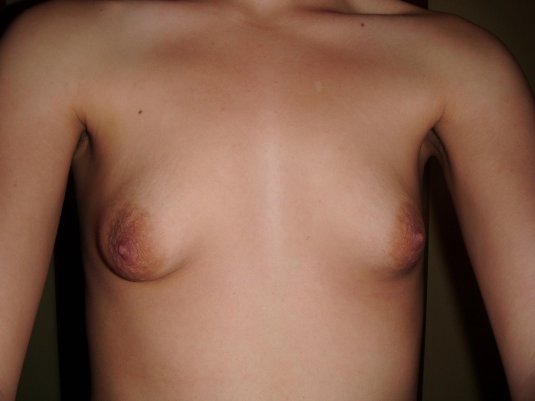 Маленькие некрасивые сиськи