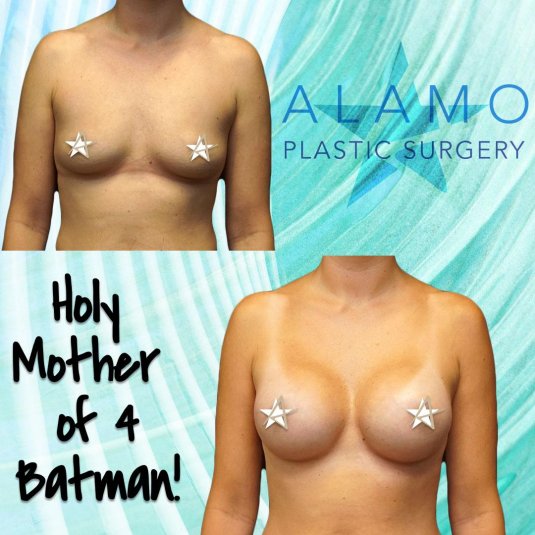 Увеличение груди