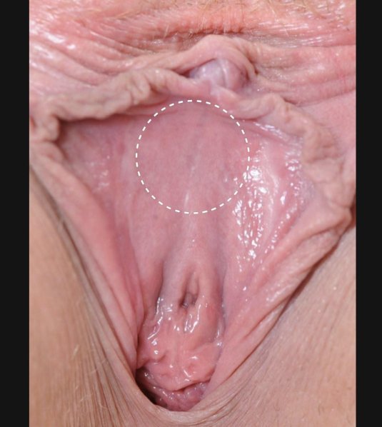 Женская вагина