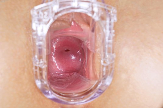 Здоровое влагалище изнутри