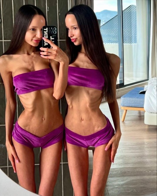 Аделина и алина фатхеевы